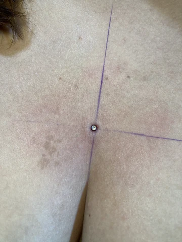 Microdermal con joya de titanio